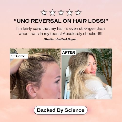 TheraBrush™ – 3-in-1 Red Light Hair Renewal + FREE Growth Serum